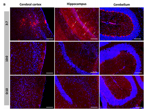 被包裹在含有NT-类脂质的LNP中的Cre重组酶乐成转移。。。。。大脑中的转染神经元呈红色高亮。。。。。