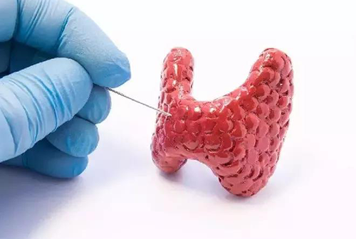 甲状腺疾病，，包括甲状腺功效减退和甲状腺功效亢进，，自古以来就是重复被医学研究职员研究的疾病