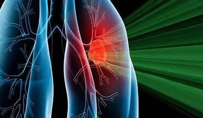 盛世泰科1类立异药物CGT-9475实现中美双报双批 | CA88一站式临床宿世物医药研发服务平台助力