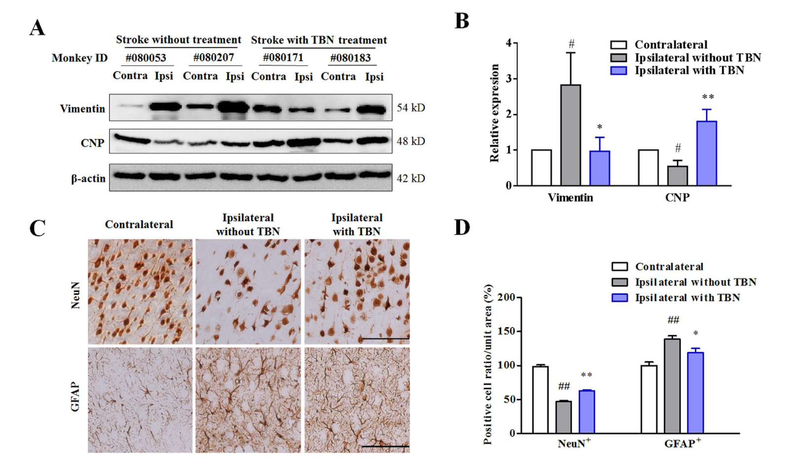 TBN是一种治疗缺血性卒中的新型临床候选药物，，，本研究中TBN通过CA88合成